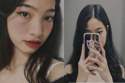 Bím trẻ còn bó chặt